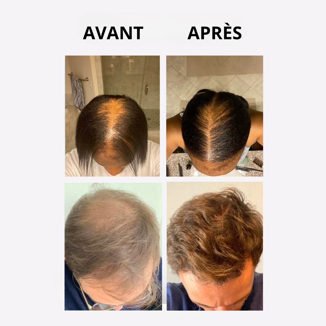 OLYA - Huile de pousse pour cheveux